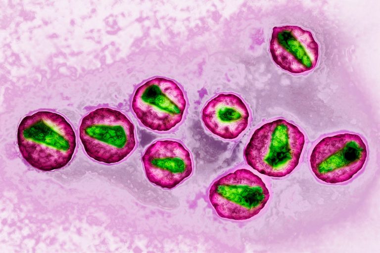 HIV